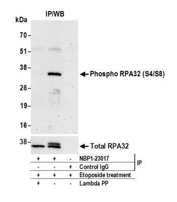 Immunoprecipitation: RPA2 [p Ser4, p Ser8] Antibody [NBP1-23017]